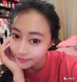 网红张月整容,揭秘网红蜕变之路